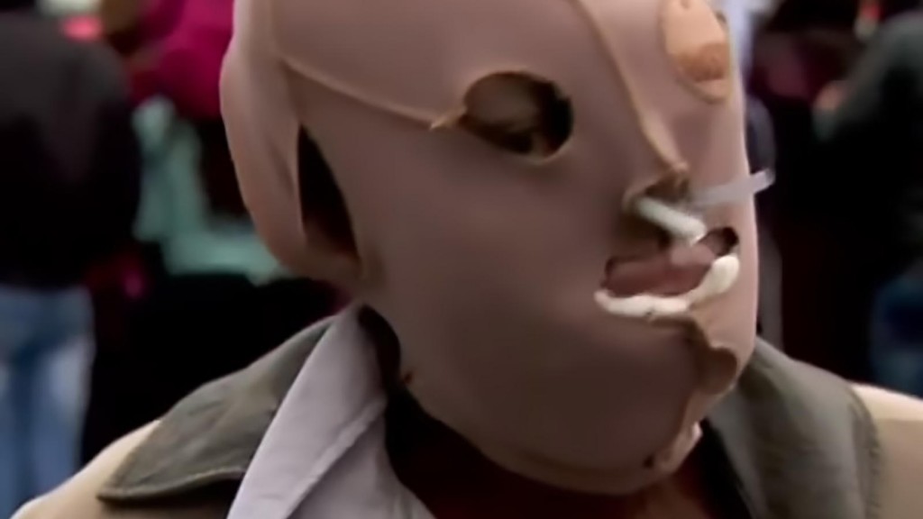 saeure-opfer-consuela-cordoba-will-sterben-doch-papst-besuch-veraendert-ihr-leben