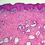 1508396034617.jpg--cancro__si_alla_terapia_genetica_che_crea_le_cellule_farmaco__un_passo_in_avanti_decisivo_