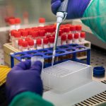 Coronavirus: somministrata la cura