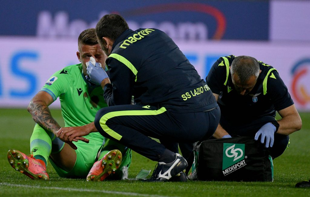 Milinkovic operato al naso